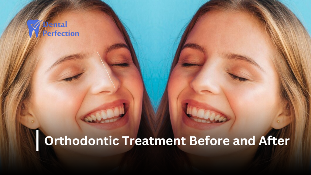 orthodontic treatment before and after